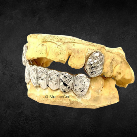 BlueIceGems- The Ice & Slice Patterned Grillz (2)